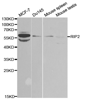 Anti RIP2 Antibody thumbnail image 1