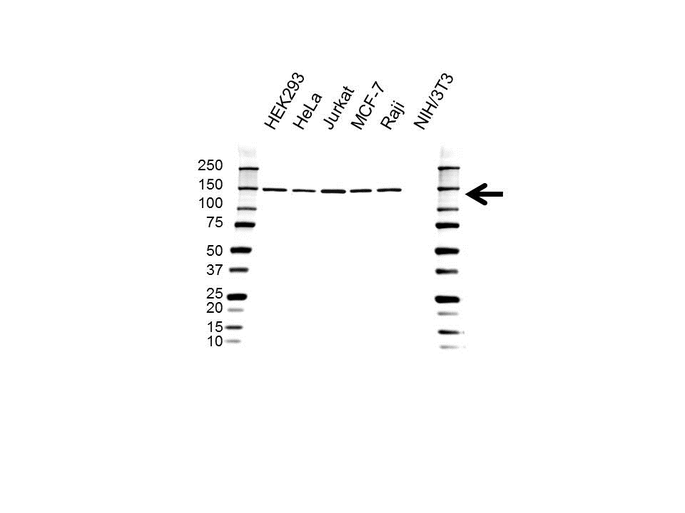Anti RNA Helicase A Antibody (PrecisionAb Polyclonal Antibody) gallery image 1