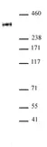 Anti Human RNA Pol II CTD (pThr4) Antibody thumbnail image 1