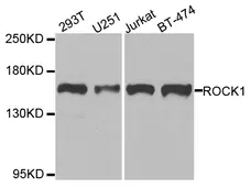 Anti ROCK1 Antibody gallery image 1