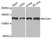 Anti ROCK1 Antibody thumbnail image 1