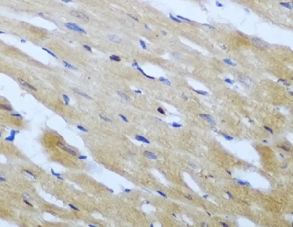 Anti ROCK1 Antibody gallery image 2
