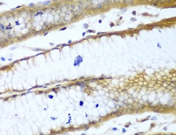 Anti ROCK1 Antibody gallery image 3