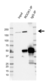 Anti ROCK1 Antibody (PrecisionAb Polyclonal Antibody) thumbnail image 2