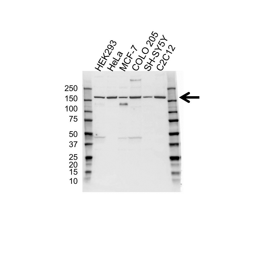 Anti ROCK2 Antibody (PrecisionAb Polyclonal Antibody) gallery image 1