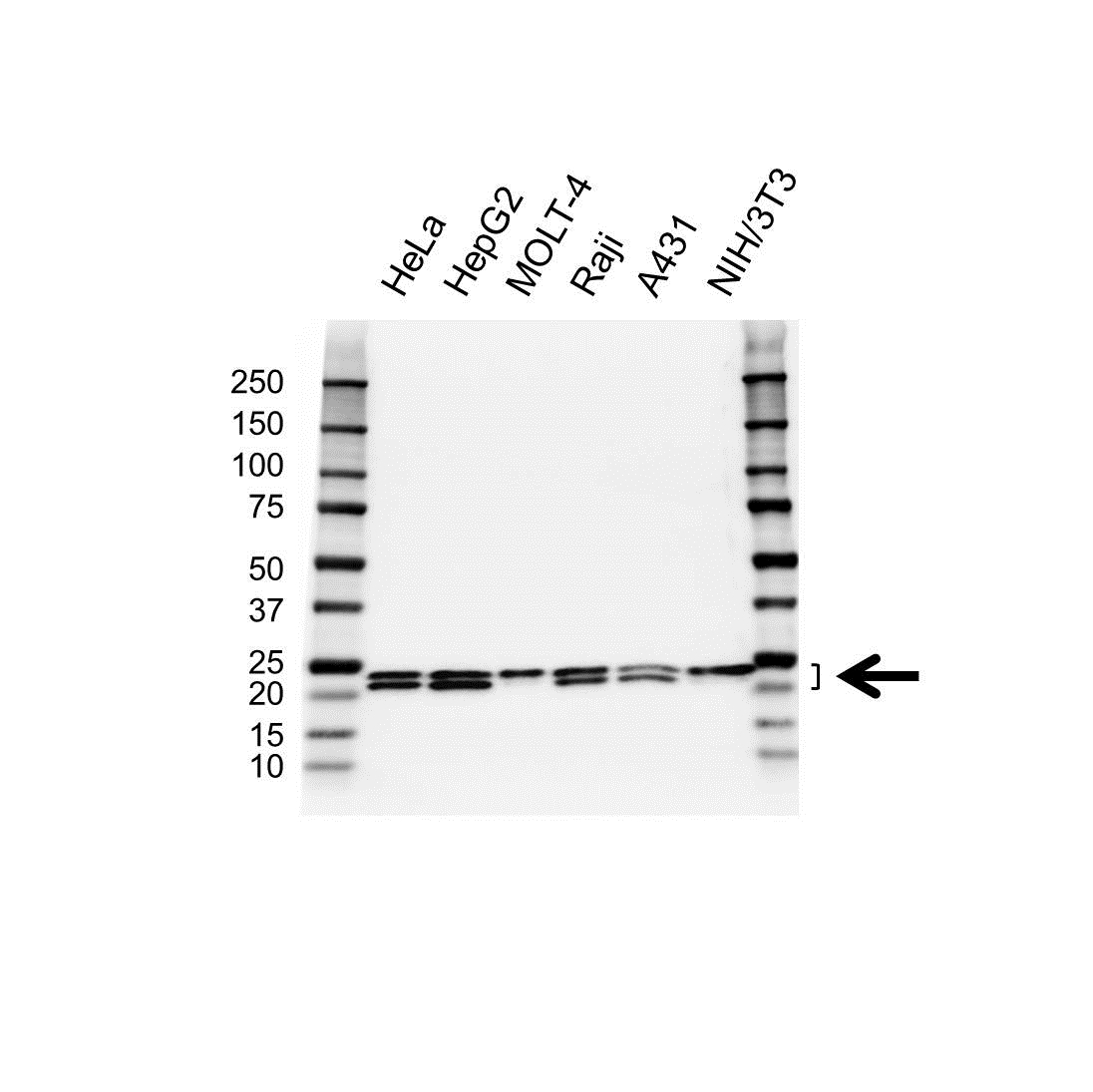 Anti RPL17 Antibody (PrecisionAb Polyclonal Antibody) gallery image 1