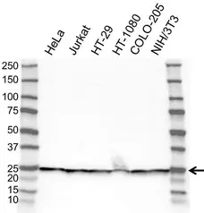 Anti RPL18 Antibody (PrecisionAb Polyclonal Antibody) gallery image 1