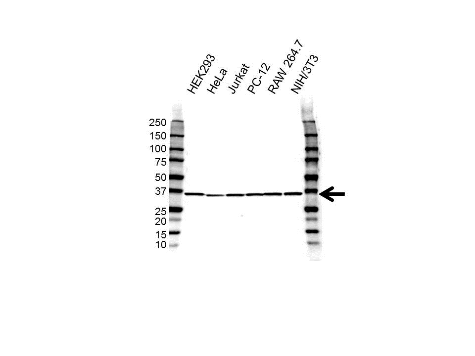 Anti RPLP0 Antibody (PrecisionAb Polyclonal Antibody) gallery image 1