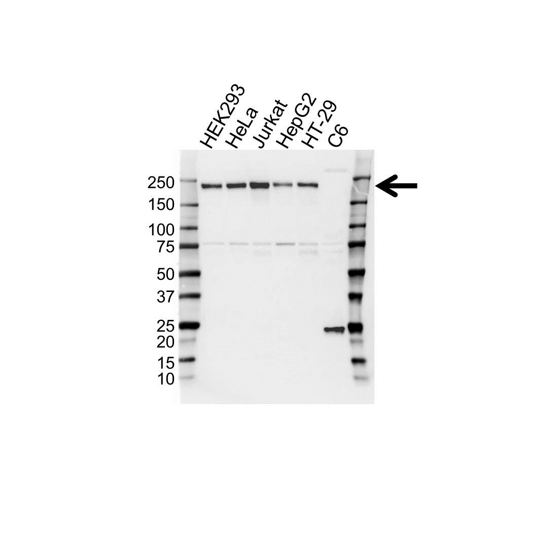 Anti RPRD2 Antibody (PrecisionAb Polyclonal Antibody) gallery image 1