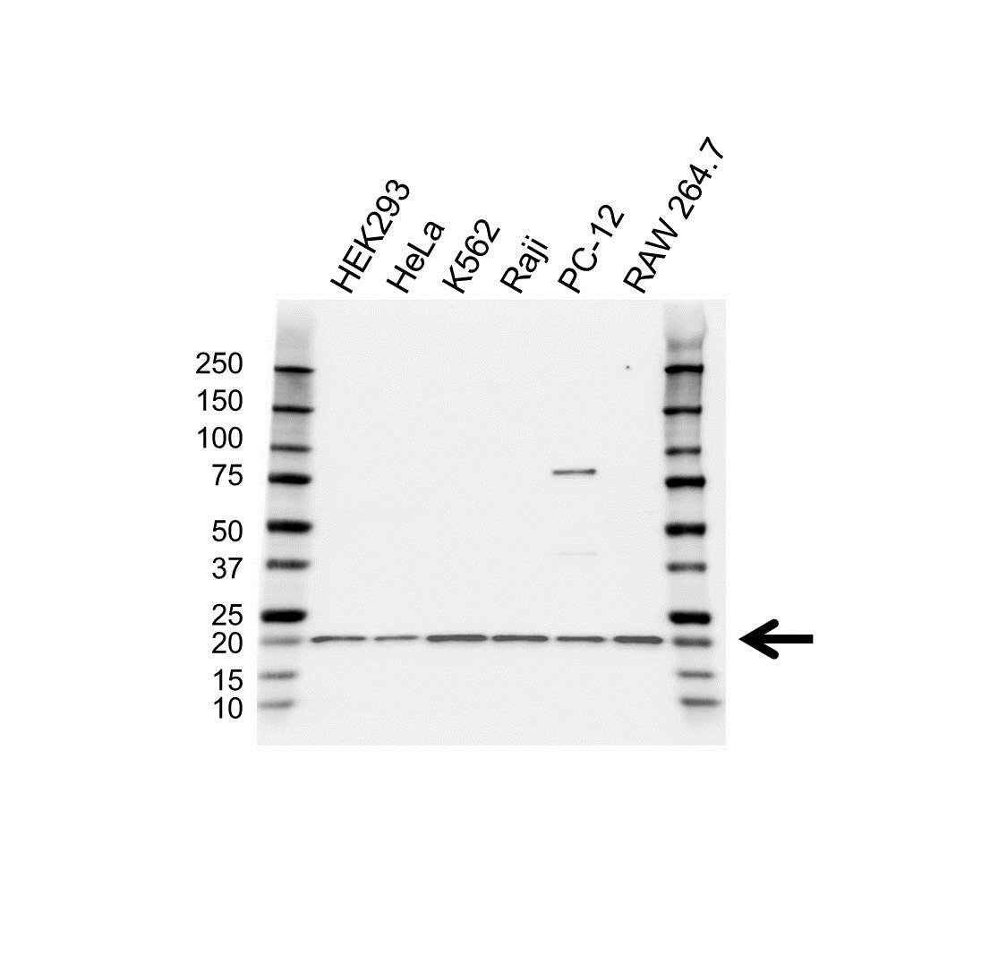 Anti RPS10 Antibody (PrecisionAb Polyclonal Antibody) gallery image 1