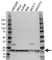 Anti RPS11 Antibody (PrecisionAb Polyclonal Antibody) thumbnail image 1