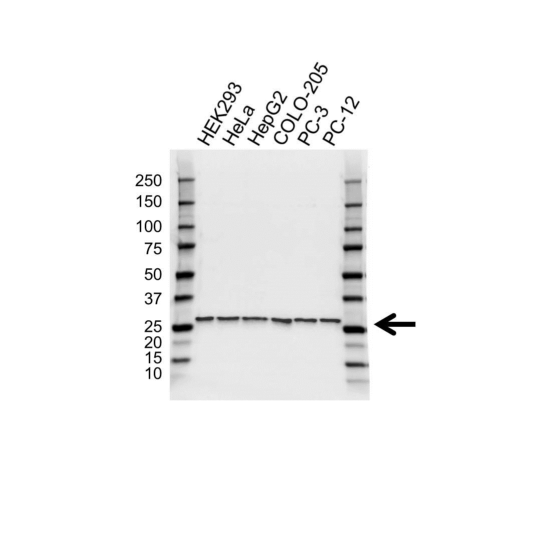 Anti RPS4X Antibody (PrecisionAb Polyclonal Antibody) gallery image 1