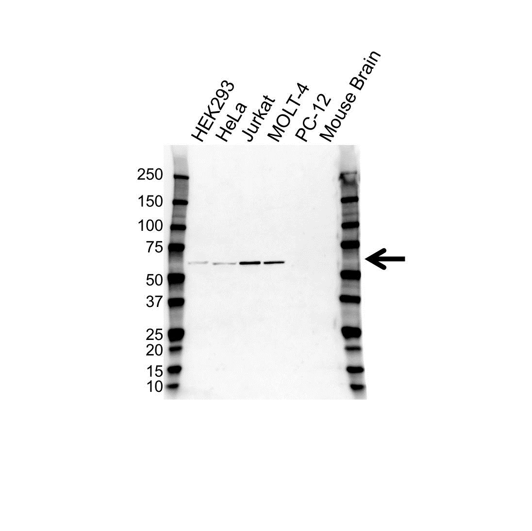 Anti RUNX1 Antibody (PrecisionAb Polyclonal Antibody) gallery image 1
