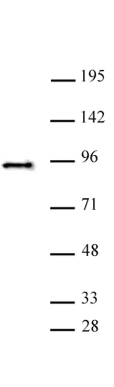 Anti Human SATB2 Antibody gallery image 1