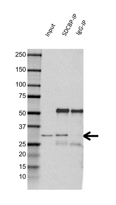 Anti SDCBP Antibody (PrecisionAb Polyclonal Antibody) gallery image 2