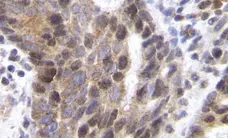 Anti Human SDF-1 Alpha Antibody gallery image 1