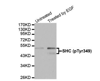 Anti SHC1 (pTyr349) Antibody gallery image 1