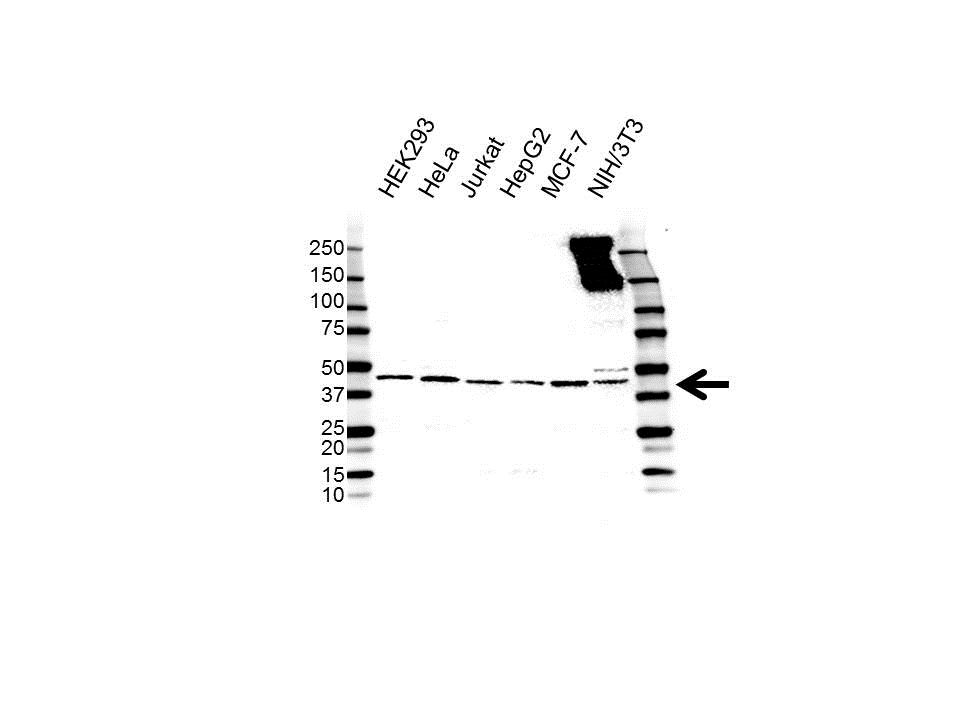 Anti SKAP2 Antibody (PrecisionAb Polyclonal Antibody) gallery image 1