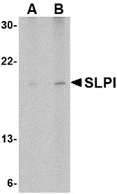 Anti SLPI Antibody gallery image 1