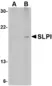 Anti SLPI Antibody thumbnail image 1