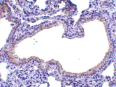 Anti SLPI Antibody gallery image 2