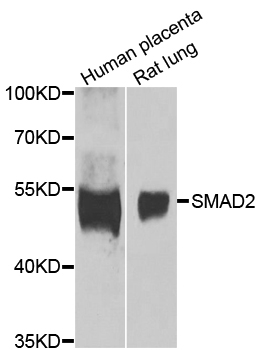 Anti SMAD2 Antibody gallery image 1