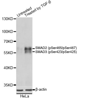 Anti SMAD2 (pSer465/pSer467)/SMAD3 (pSer423/pSer425) Antibody gallery image 1