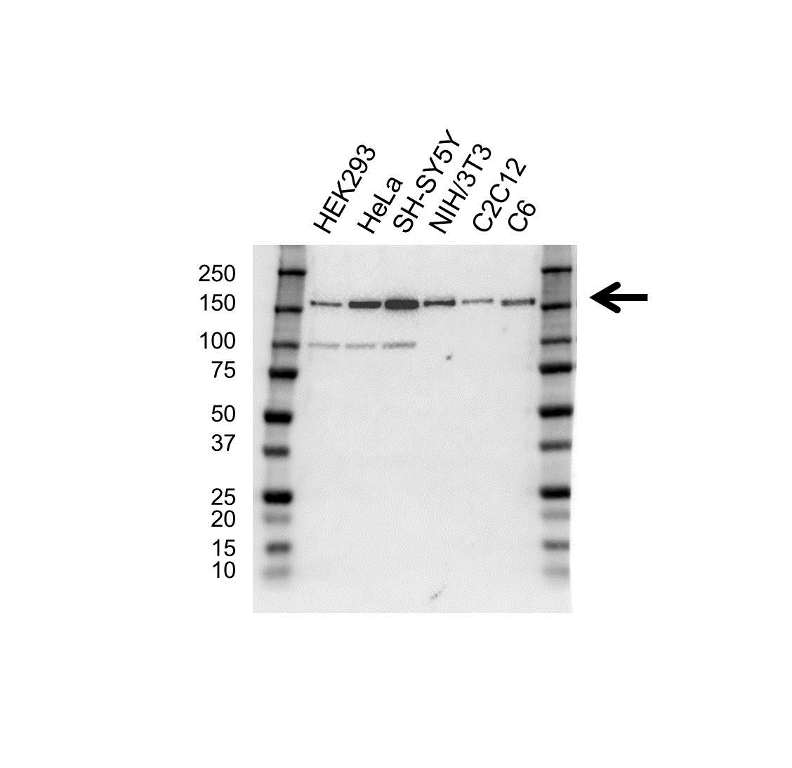 Anti SMARCC1 Antibody (PrecisionAb Polyclonal Antibody) gallery image 1