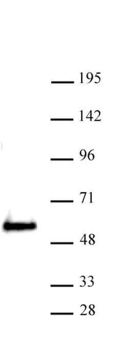 Anti Human SMARCE1 Antibody gallery image 1