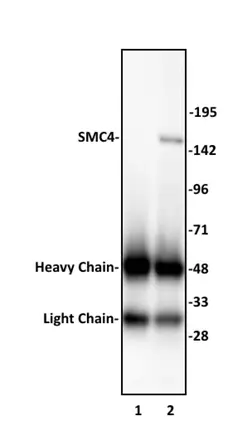 Anti Human SMC4 Antibody gallery image 1