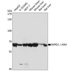 Anti SMPD1 Antibody gallery image 2
