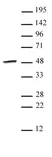 Anti Human SMYD3 Antibody thumbnail image 1