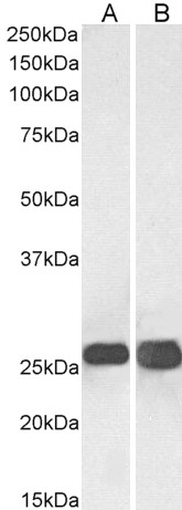 Anti SNAP-25 (C-Terminal) Antibody gallery image 1