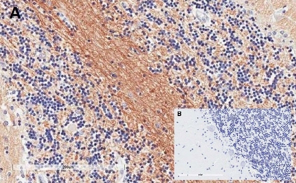Anti SNAP-25 (C-Terminal) Antibody gallery image 2