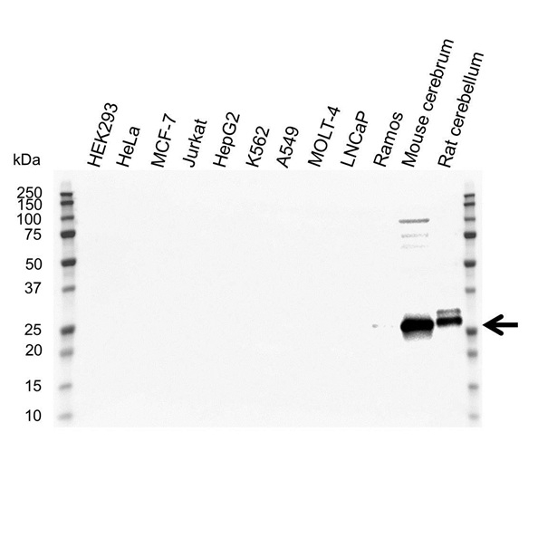 Anti SNAP-25 Antibody (PrecisionAb Polyclonal Antibody) gallery image 1