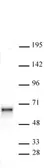 Anti Human SOX11 Antibody thumbnail image 1