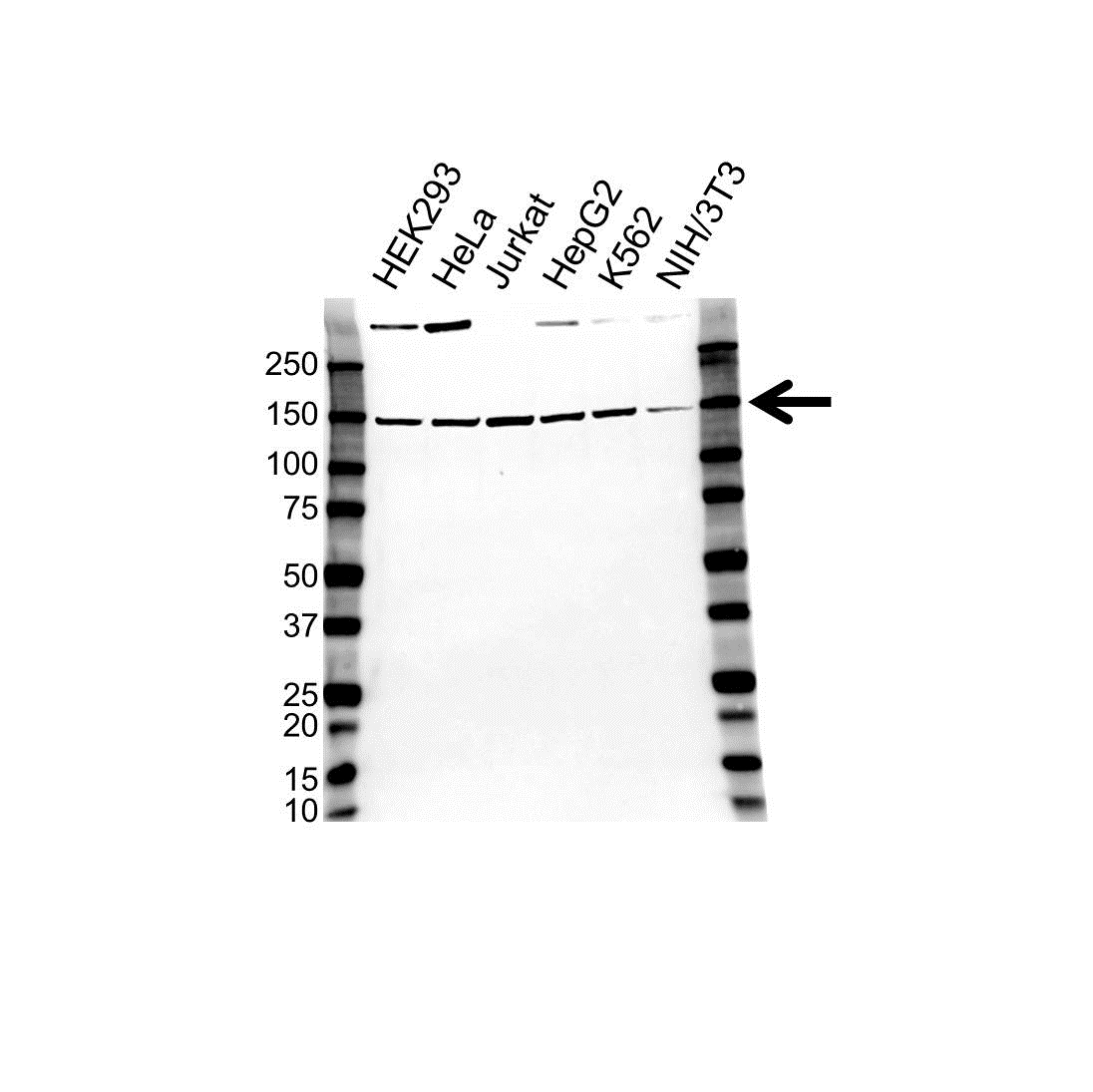 Anti Splicing Factor 3B Subunit 1 Antibody (PrecisionAb Polyclonal Antibody) gallery image 1