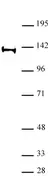 Anti Human SPT16 Antibody thumbnail image 1