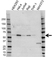 Anti SQSTM1 Antibody (PrecisionAb Polyclonal Antibody) thumbnail image 1