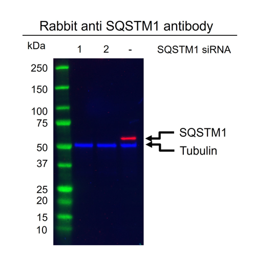 Anti SQSTM1 Antibody (PrecisionAb Polyclonal Antibody) gallery image 2