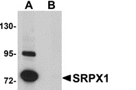 Anti SRPX1 Antibody gallery image 1