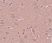 Anti SRPX1 Antibody thumbnail image 2