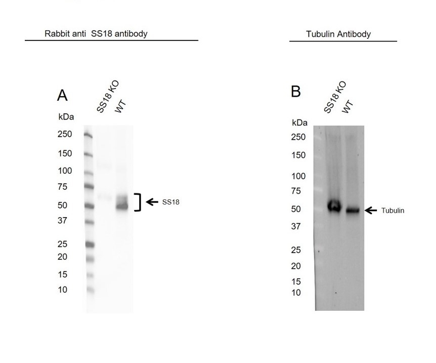 Anti SS18 Antibody (PrecisionAb Polyclonal Antibody) gallery image 2