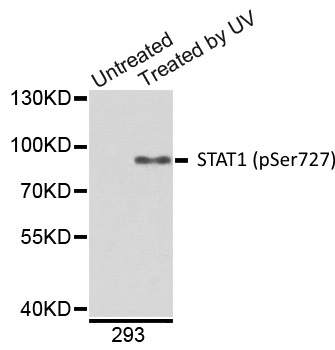 Anti STAT1 (pSer727) Antibody gallery image 1