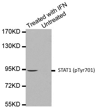 Anti STAT1 (pTyr701) Antibody gallery image 1