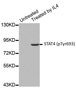Anti STAT4 (pTyr693) Antibody gallery image 1