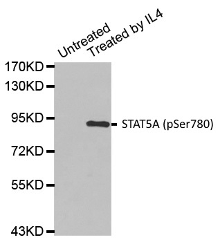 Anti STAT5A (pSer780) Antibody gallery image 1