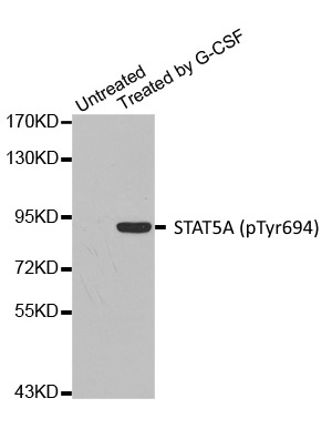 Anti STAT5A (pTyr694) Antibody gallery image 1