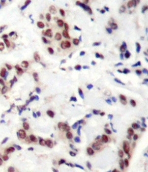Anti STAT5A (pTyr694) Antibody gallery image 2