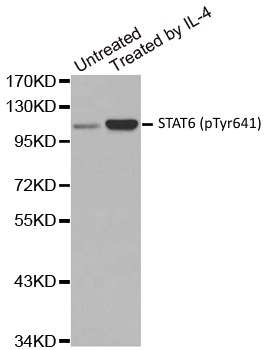 Anti STAT6 (pTyr641) Antibody gallery image 1